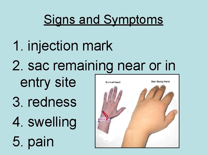 Signs and Symptoms 1. injection mark 2. sac remaining near or in entry site
