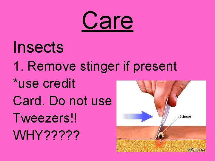 Care Insects 1. Remove stinger if present *use credit Card. Do not use Tweezers!!