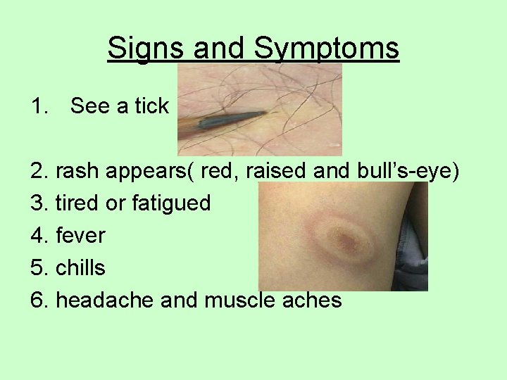 Signs and Symptoms 1. See a tick 2. rash appears( red, raised and bull’s-eye)