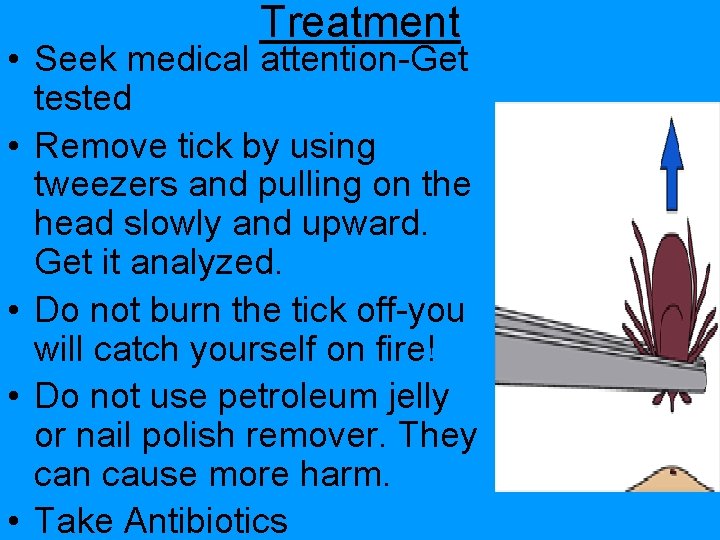 Treatment • Seek medical attention-Get tested • Remove tick by using tweezers and pulling