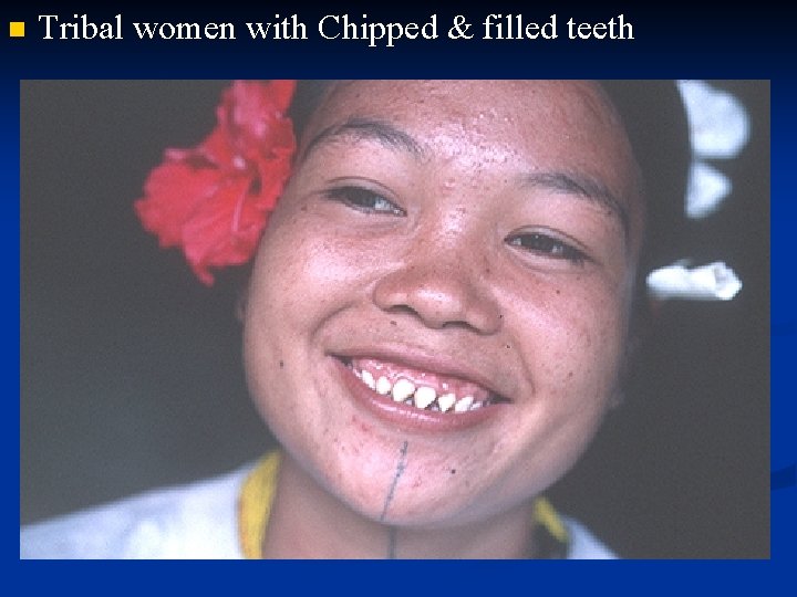 n Tribal women with Chipped & filled teeth 