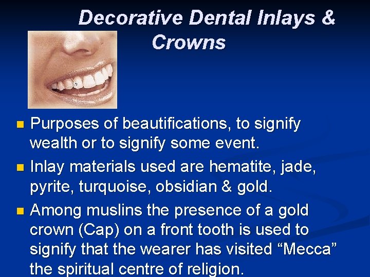Decorative Dental Inlays & Crowns Purposes of beautifications, to signify wealth or to signify