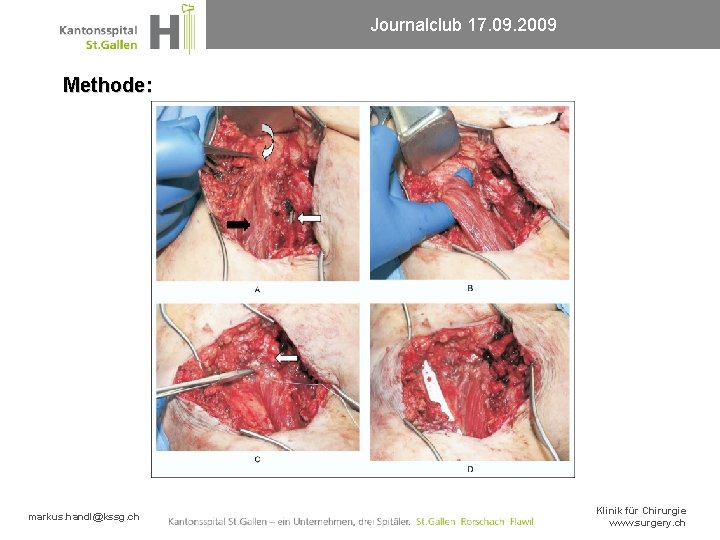 Journalclub 17. 09. 2009 Methode: markus. handl@kssg. ch Klinik für Chirurgie www. surgery. ch