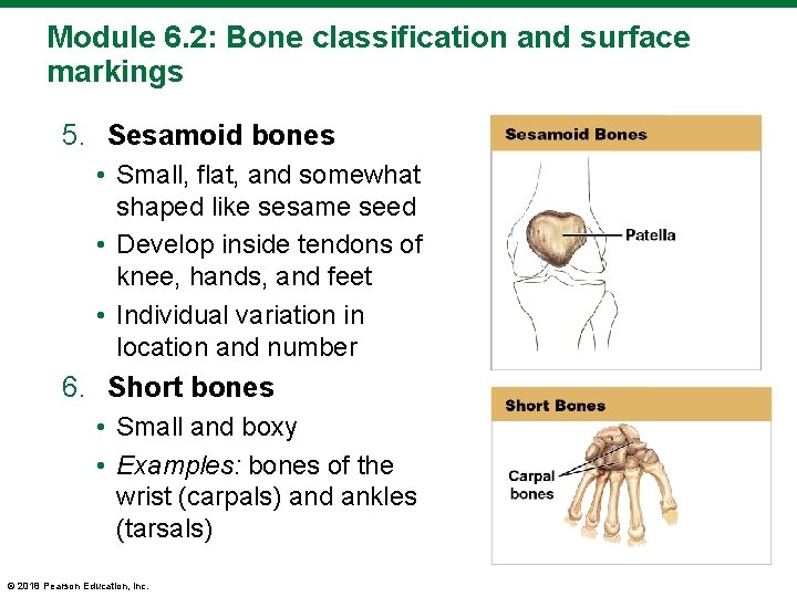 Module 6. 2: Bone classification and surface markings 5. Sesamoid bones • Small, flat,