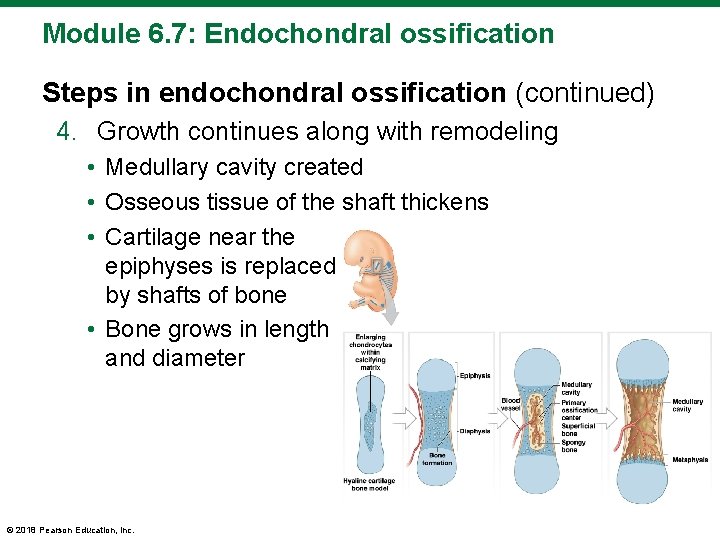 Module 6. 7: Endochondral ossification Steps in endochondral ossification (continued) 4. Growth continues along
