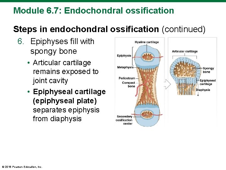 Module 6. 7: Endochondral ossification Steps in endochondral ossification (continued) 6. Epiphyses fill with