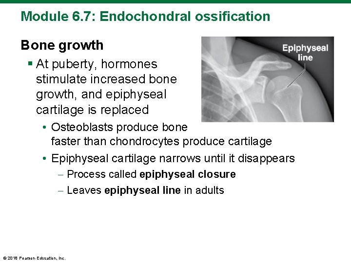 Module 6. 7: Endochondral ossification Bone growth § At puberty, hormones stimulate increased bone