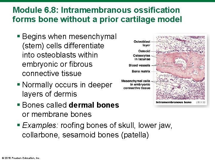 Module 6. 8: Intramembranous ossification forms bone without a prior cartilage model § Begins