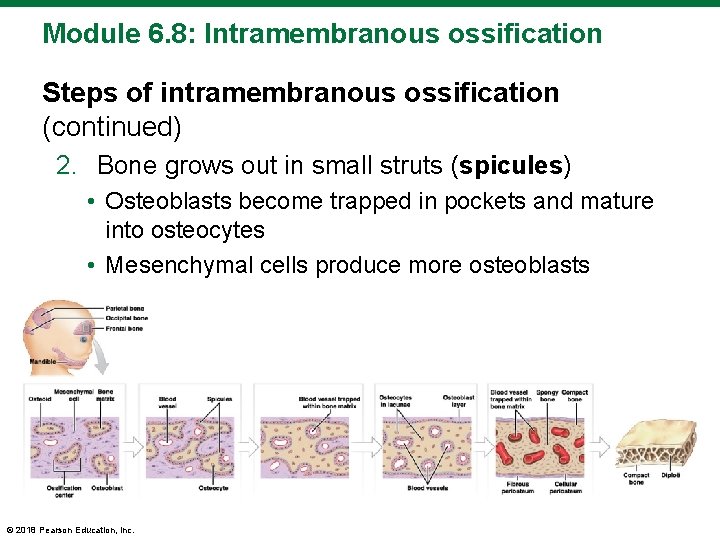 Module 6. 8: Intramembranous ossification Steps of intramembranous ossification (continued) 2. Bone grows out