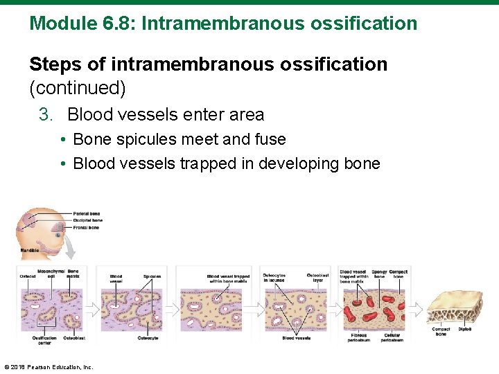 Module 6. 8: Intramembranous ossification Steps of intramembranous ossification (continued) 3. Blood vessels enter