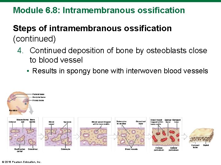 Module 6. 8: Intramembranous ossification Steps of intramembranous ossification (continued) 4. Continued deposition of
