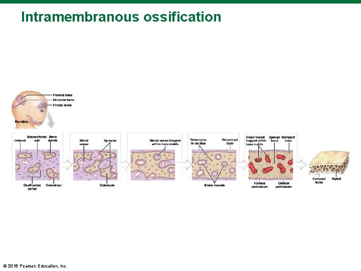 Intramembranous ossification © 2018 Pearson Education, Inc. 