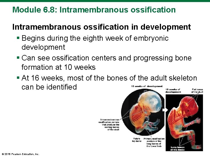 Module 6. 8: Intramembranous ossification in development § Begins during the eighth week of