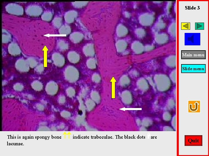 Slide 3 Main menu Slide menu This is again spongy bone indicate trabeculae. The