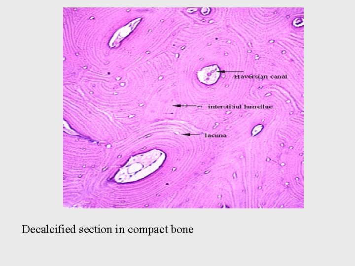 Decalcified section in compact bone 