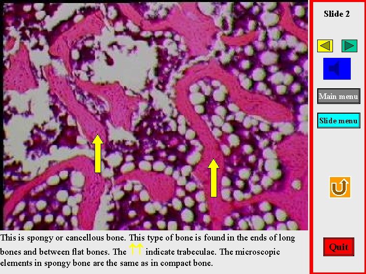 This is spongy or cancellous bone. This type of bone is found in the