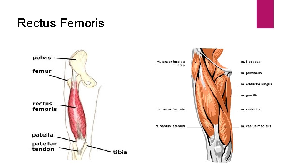 Rectus Femoris 