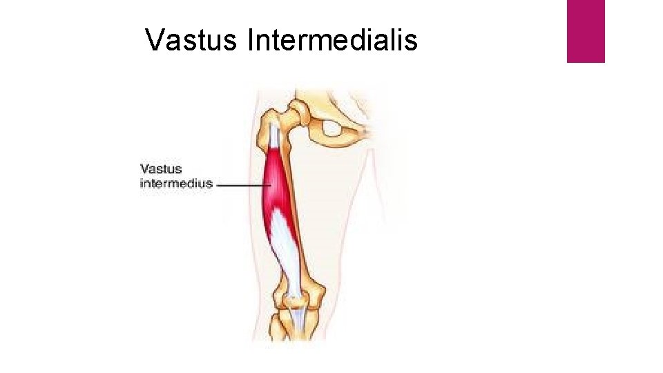 Vastus Intermedialis 