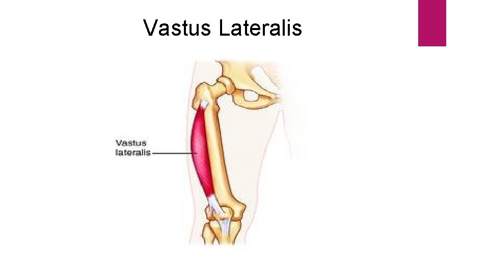 Vastus Lateralis 