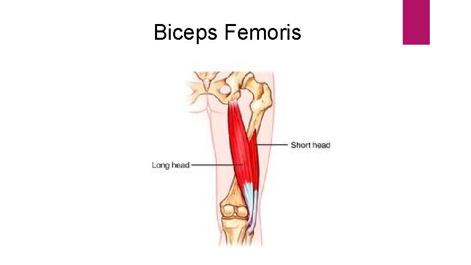 Biceps Femoris 