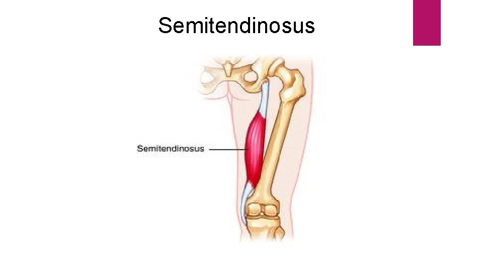 Semitendinosus 
