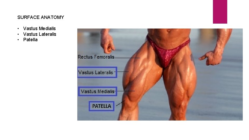 SURFACE ANATOMY • Vastus Medialis • Vastus Lateralis • Patella 