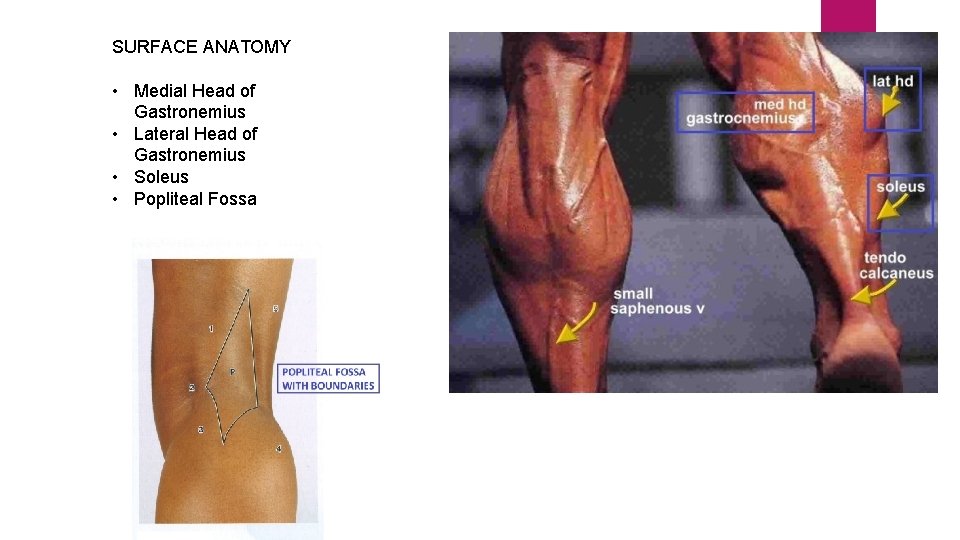 SURFACE ANATOMY • Medial Head of Gastronemius • Lateral Head of Gastronemius • Soleus