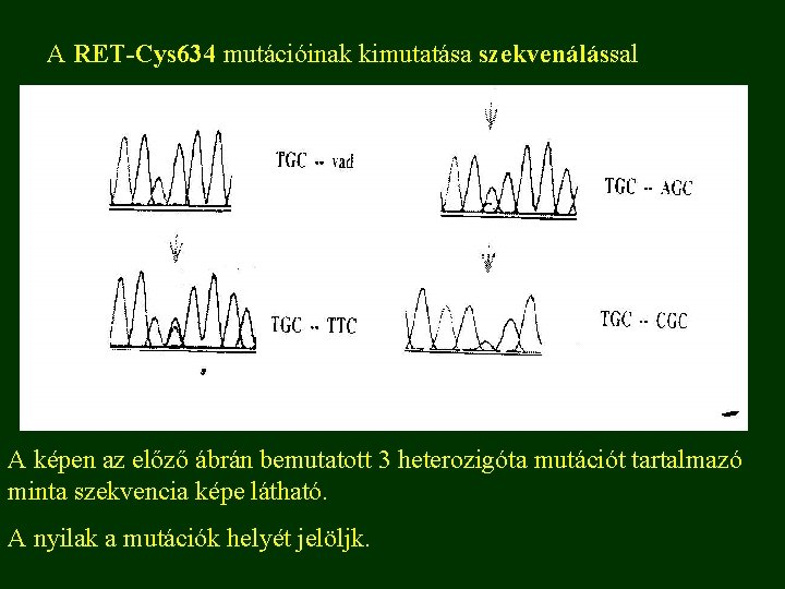 A RET-Cys 634 mutációinak kimutatása szekvenálással A képen az előző ábrán bemutatott 3 heterozigóta