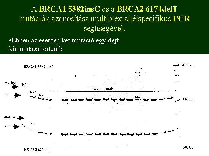A BRCA 1 5382 ins. C és a BRCA 2 6174 del. T mutációk