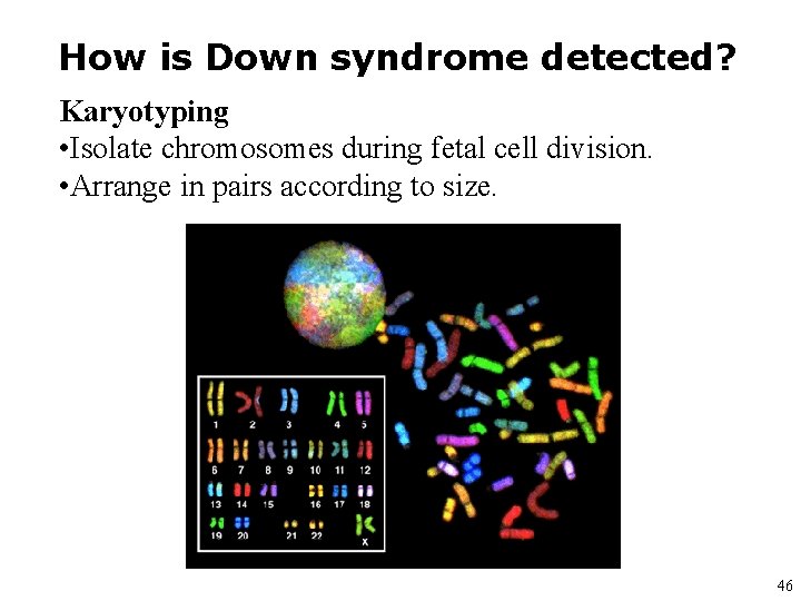 How is Down syndrome detected? Karyotyping • Isolate chromosomes during fetal cell division. •