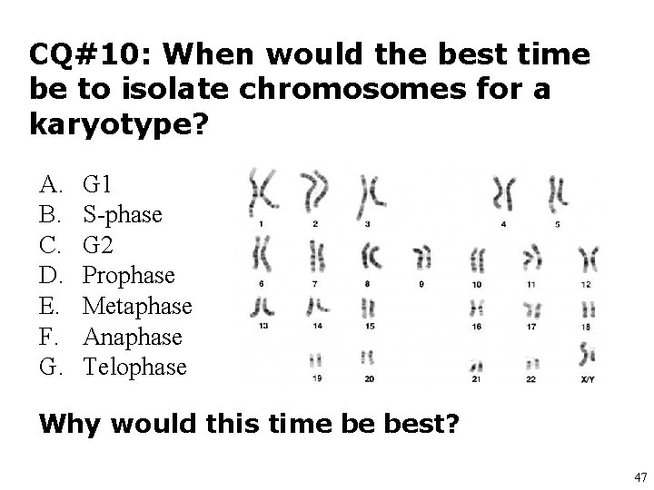 CQ#10: When would the best time be to isolate chromosomes for a karyotype? A.