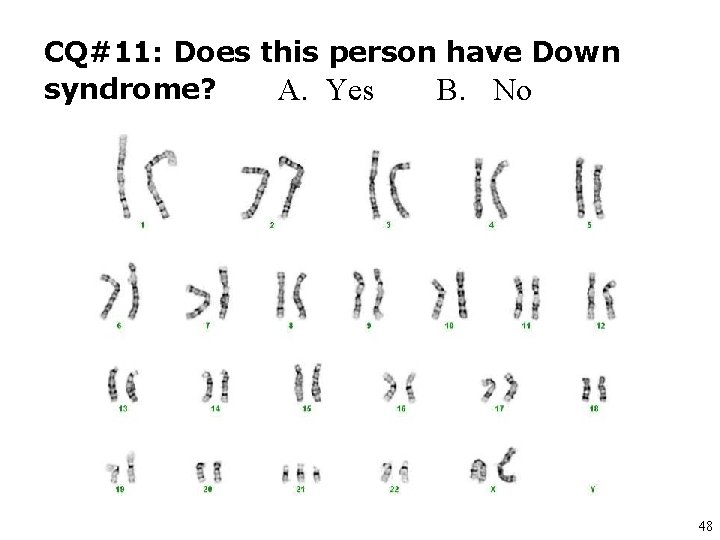 CQ#11: Does this person have Down syndrome? A. Yes B. No 48 