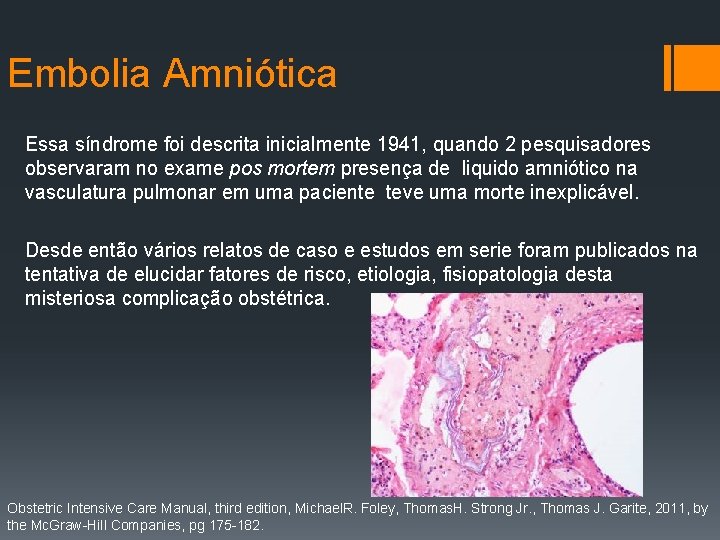 Embolia Amniótica Essa síndrome foi descrita inicialmente 1941, quando 2 pesquisadores observaram no exame