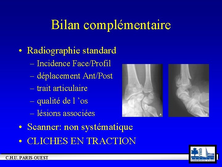 Bilan complémentaire • Radiographie standard – Incidence Face/Profil – déplacement Ant/Post – trait articulaire