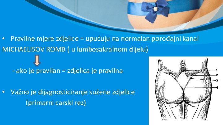 • Pravilne mjere zdjelice = upućuju na normalan porođajni kanal MICHAELISOV ROMB ( • Pravilne mjere zdjelice = upućuju na normalan porođajni kanal MICHAELISOV ROMB (