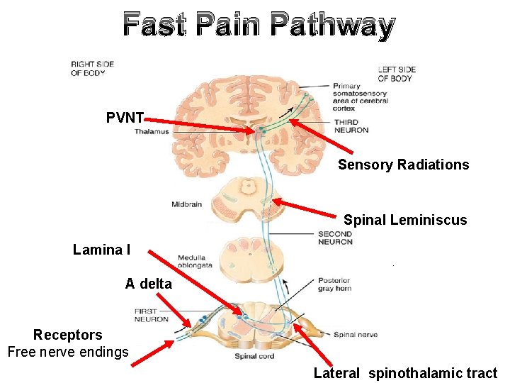 Fast Pain Pathway PVNT Sensory Radiations Spinal Leminiscus Lamina I A delta Receptors Free