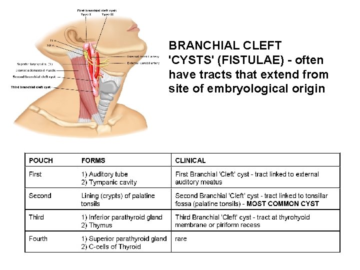 BRANCHIAL CLEFT 'CYSTS' (FISTULAE) - often have tracts that extend from site of embryological BRANCHIAL CLEFT 'CYSTS' (FISTULAE) - often have tracts that extend from site of embryological