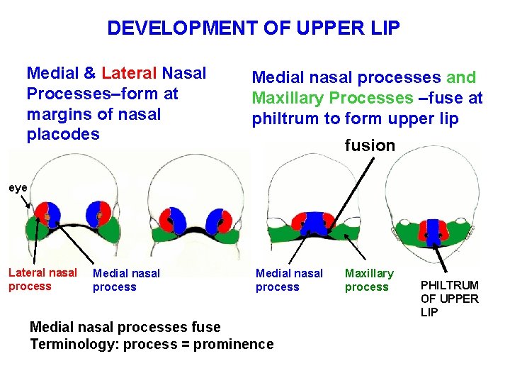 DEVELOPMENT OF UPPER LIP Medial & Lateral Nasal Processes–form at margins of nasal placodes DEVELOPMENT OF UPPER LIP Medial & Lateral Nasal Processes–form at margins of nasal placodes