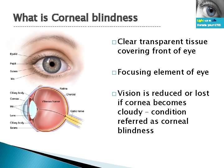 What is Corneal blindness Light up a Life ---------------------------------- Donate your EYES � Clear