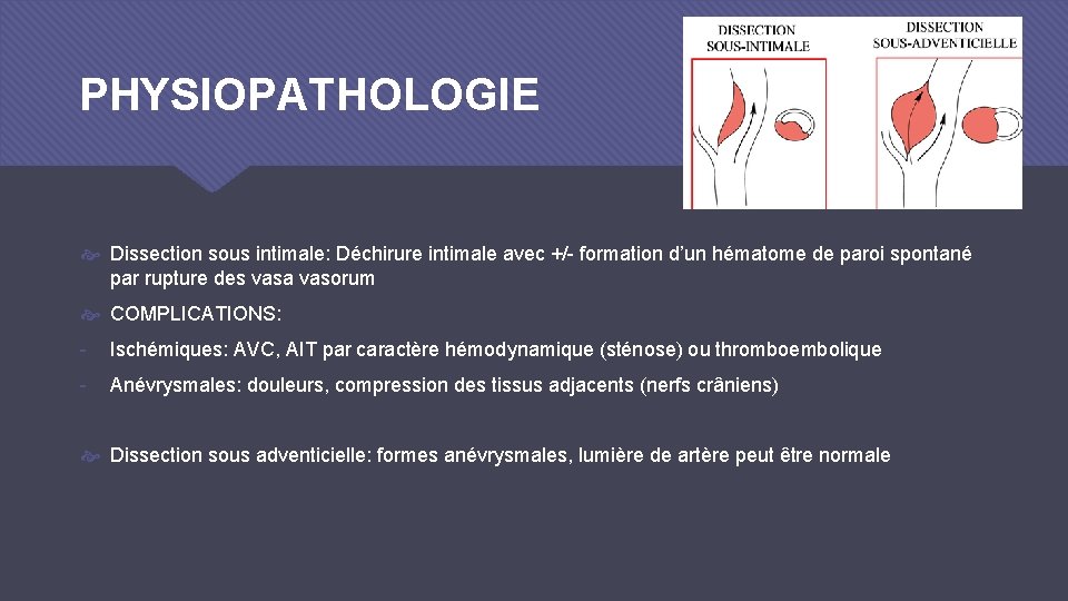 PHYSIOPATHOLOGIE Dissection sous intimale: Déchirure intimale avec +/- formation d’un hématome de paroi spontané