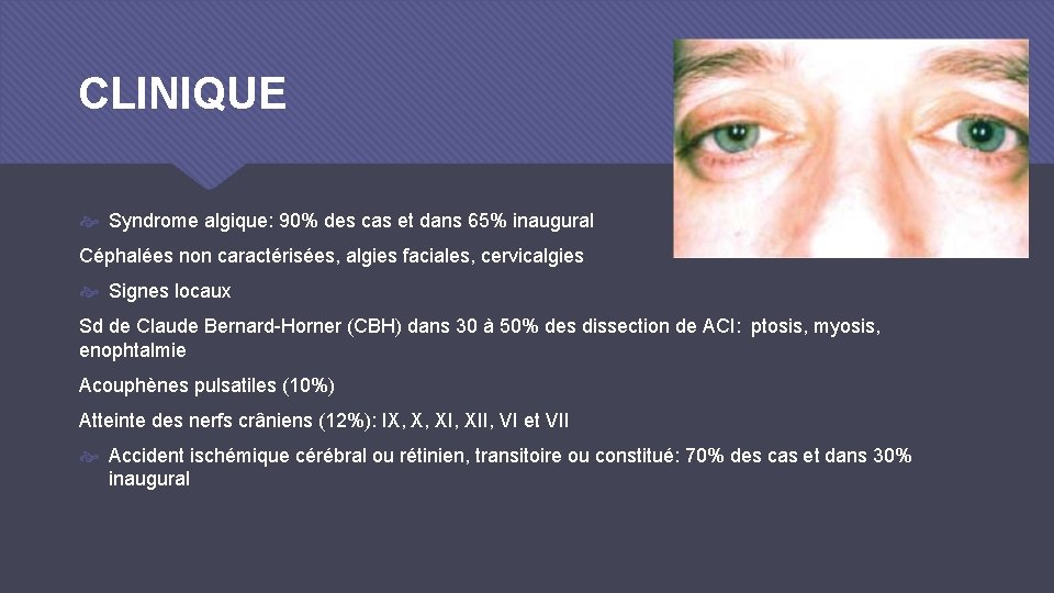 CLINIQUE Syndrome algique: 90% des cas et dans 65% inaugural Céphalées non caractérisées, algies