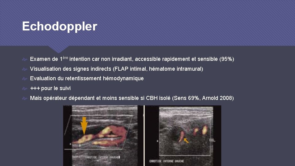 Echodoppler Examen de 1ère intention car non irradiant, accessible rapidement et sensible (95%) Visualisation