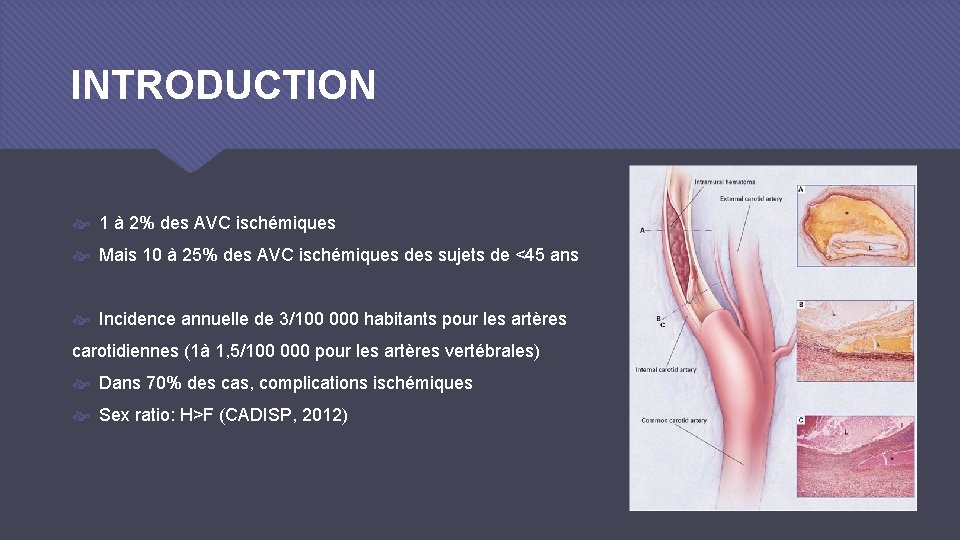 INTRODUCTION 1 à 2% des AVC ischémiques Mais 10 à 25% des AVC ischémiques