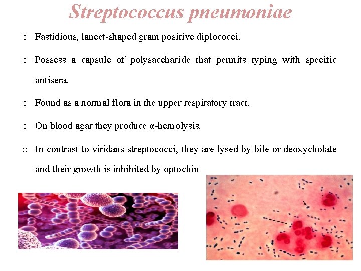 Streptococcus pneumoniae o Fastidious, lancet-shaped gram positive diplococci. o Possess a capsule of polysaccharide