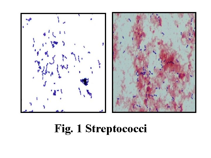 Fig. 1 Streptococci 