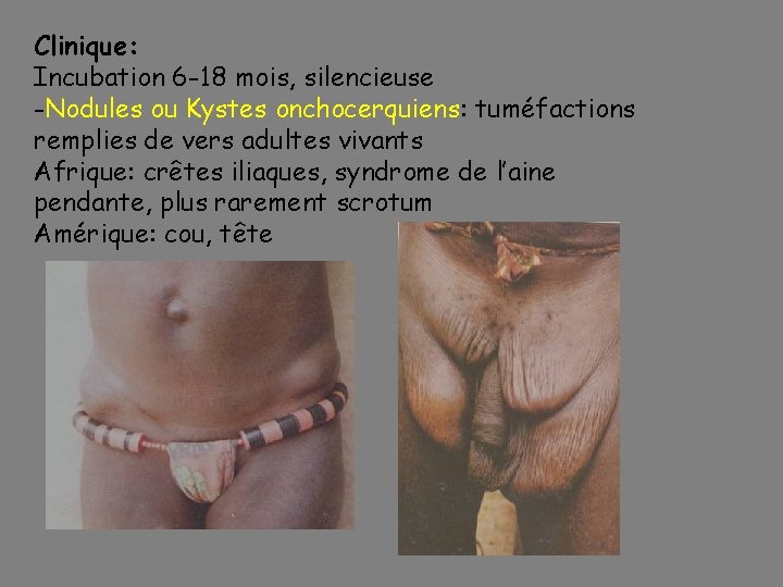 Clinique: Incubation 6 -18 mois, silencieuse -Nodules ou Kystes onchocerquiens: tuméfactions remplies de vers