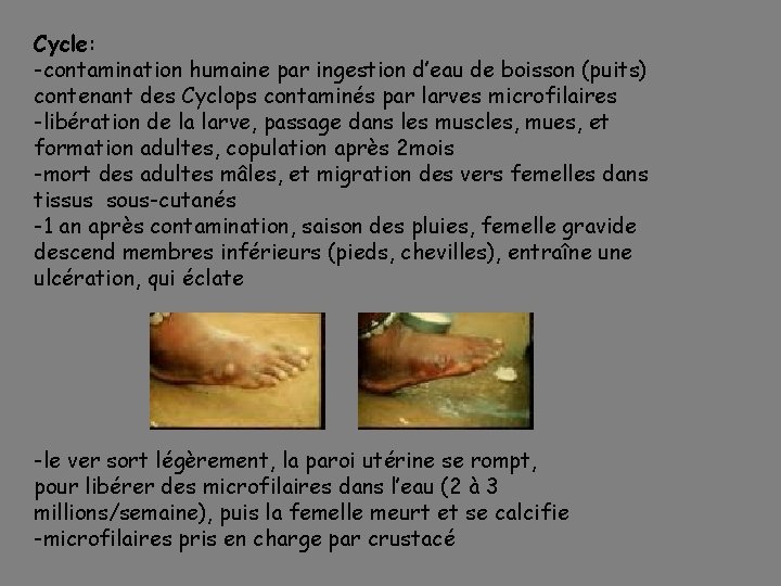 Cycle: -contamination humaine par ingestion d’eau de boisson (puits) contenant des Cyclops contaminés par