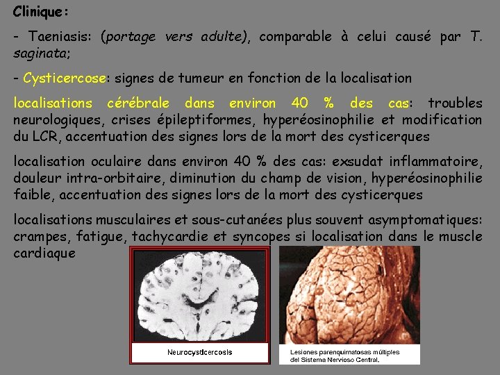 Clinique: - Taeniasis: (portage vers adulte), comparable à celui causé par T. saginata; -