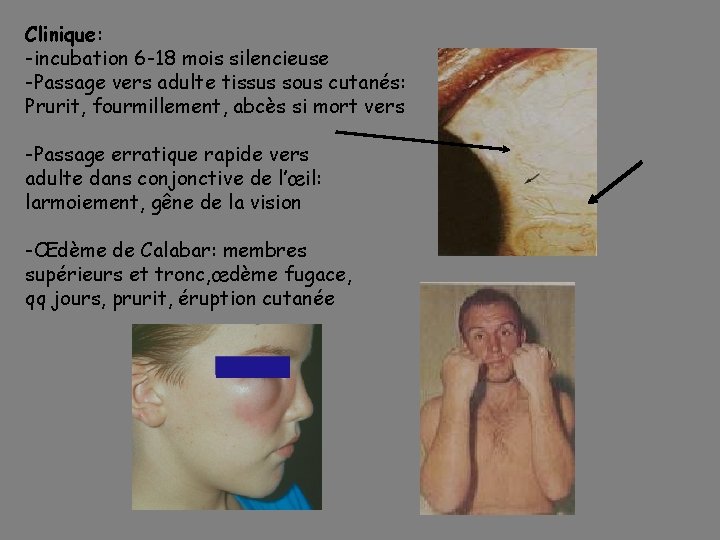 Clinique: -incubation 6 -18 mois silencieuse -Passage vers adulte tissus sous cutanés: Prurit, fourmillement,