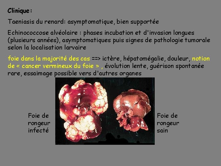 Clinique: Taeniasis du renard: asymptomatique, bien supportée Echinococcose alvéolaire : phases incubation et d'invasion